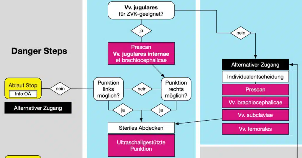 Mögliches Vorgehen zur ultraschallgestützten Punkion.