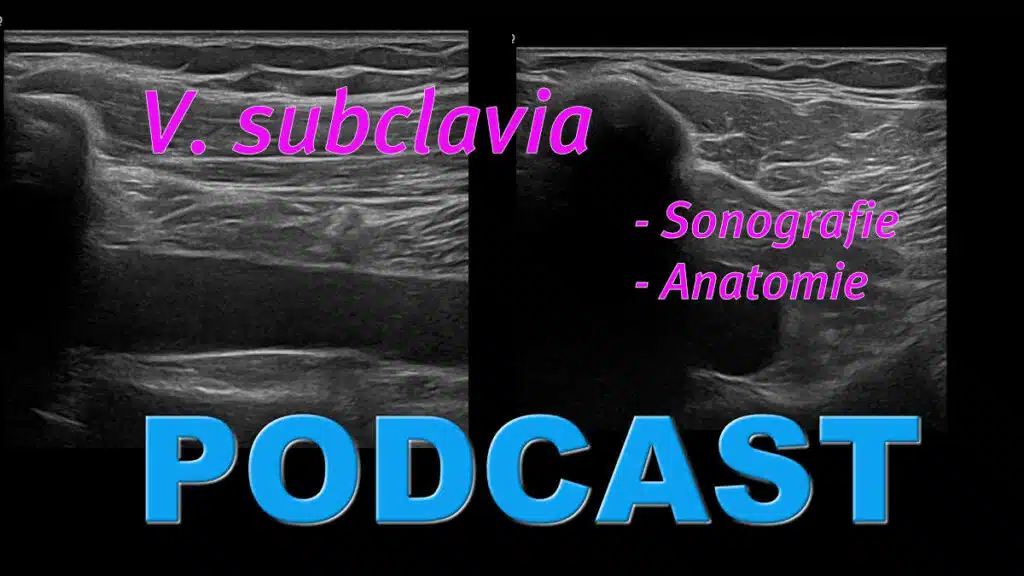 Sonoanatomie für die ultraschallgestützte V. subclavia Punktion