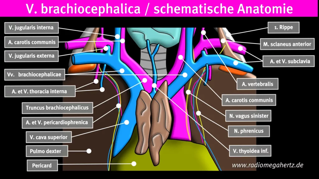 V. brachiocephalica Anatomie für ZVK Anlage