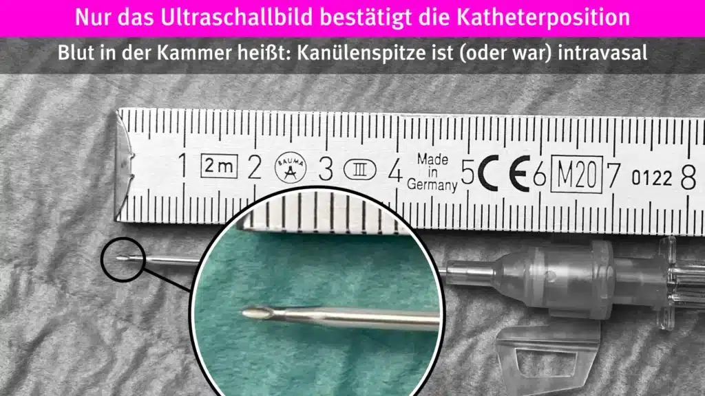 Die Katheterlage wird auch bei peripheren Venen sonografisch überprüft