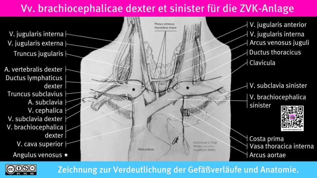 Topografische Anatomie Vena brachiocephalica, Zeichnung Georg Feigl, Radiomegahertz