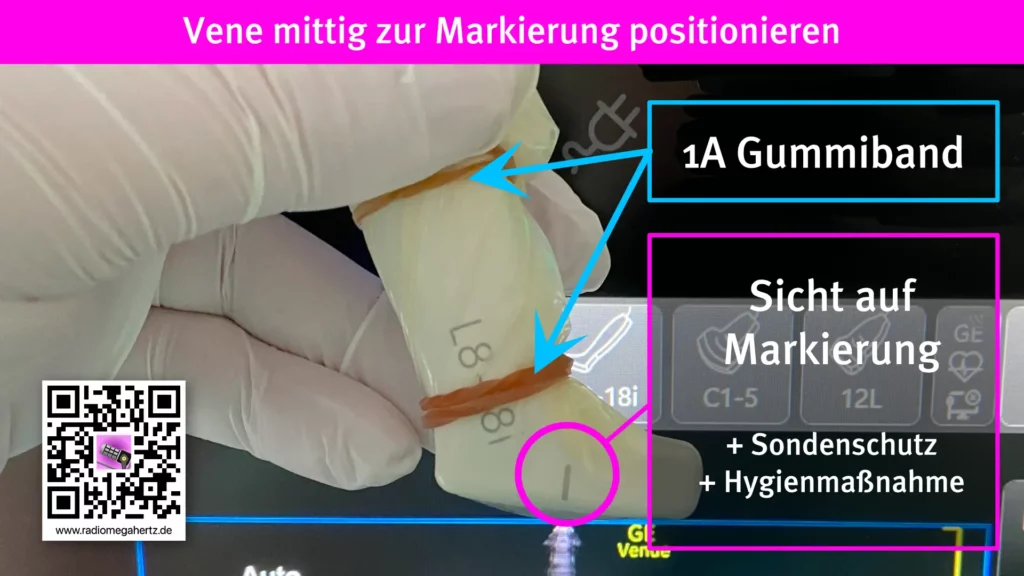 Ein einfaches Gummiband fixiert den Sondenüberzug damit er stramm anliegt, die Sondenmanöver einfacher werden und die Sicht auf die Sondenmarkierung erhalten bleibt. Radiomegahertz