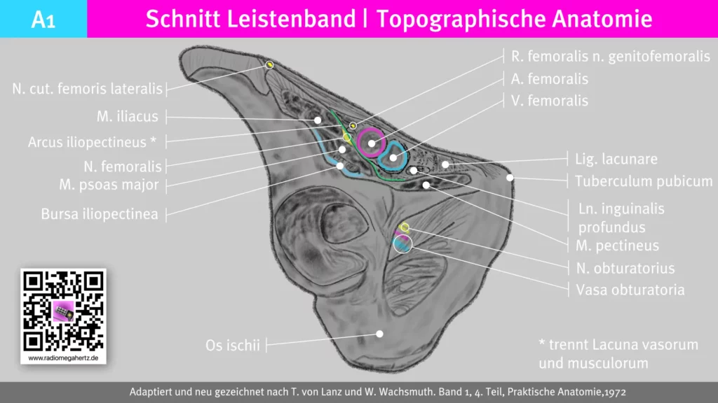 Topographische Anatomiezeichnung auf Höhe des Leistenbandes zur Verdeutlichung der lacuna musculorum et vasorum. Radiomegahertz